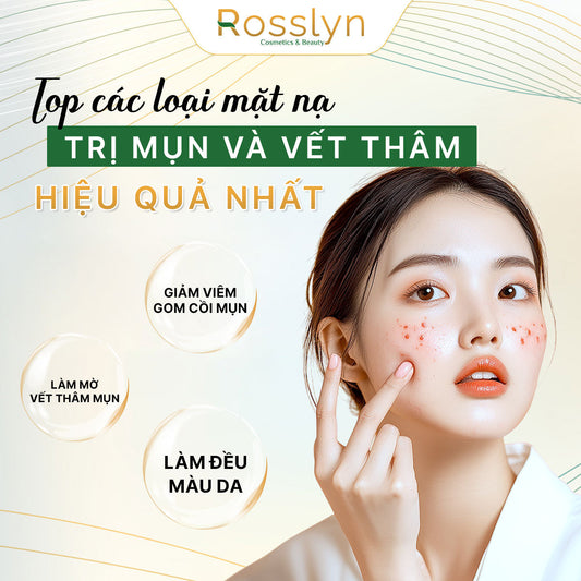 các loại mặt nạ trị mụn và vết thâm hiệu quả nhất