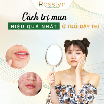 Cách trị mụn hiệu quả nhất ở tuổi dậy thì