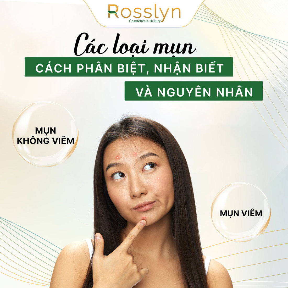 Các loại mụn