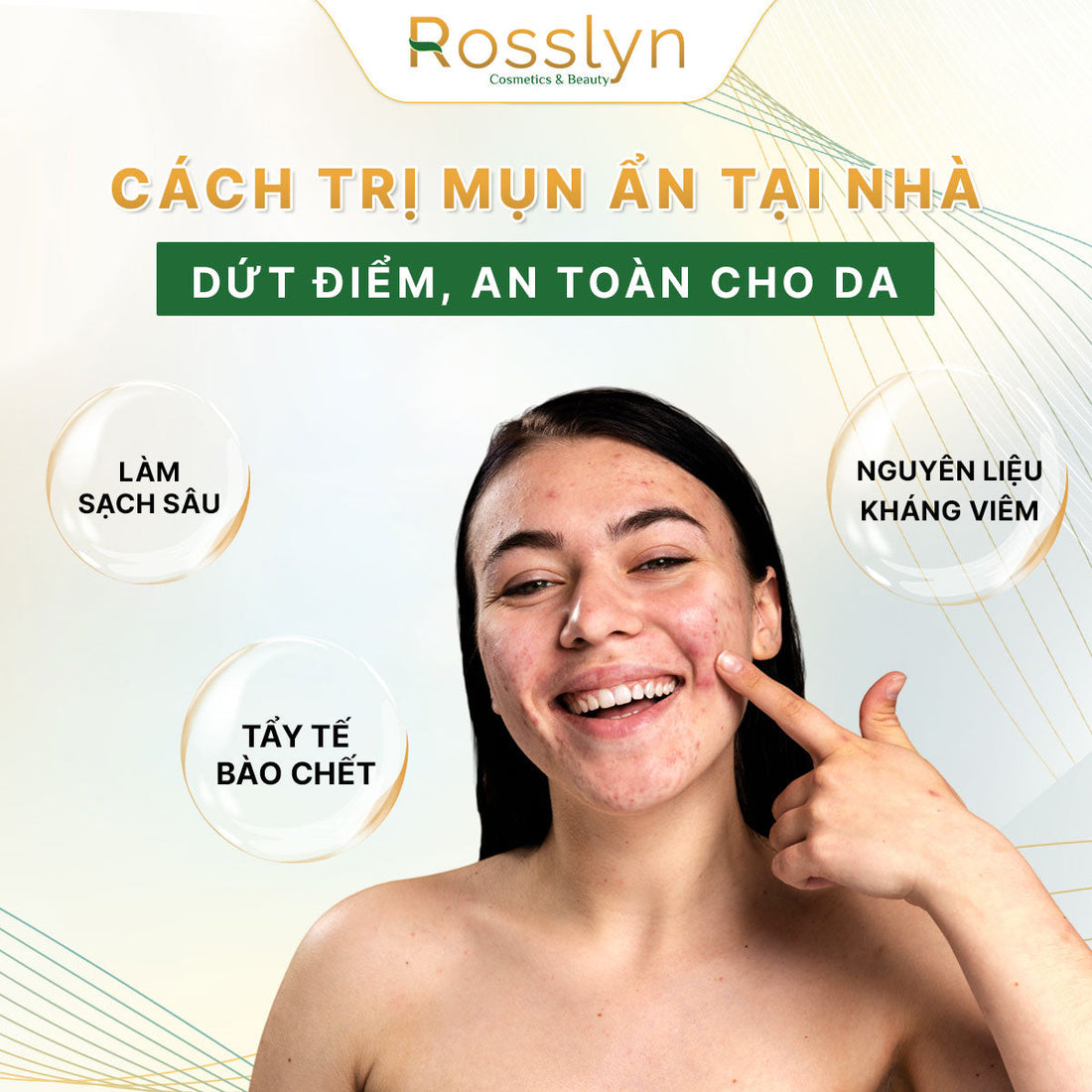 Cách trị mụn ẩn tại nhà dứt điểm