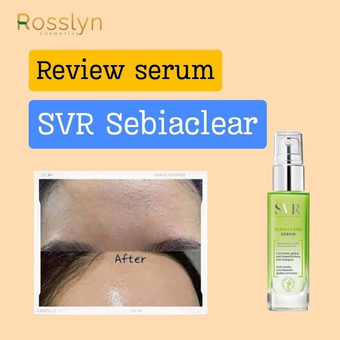 Serum trị mụn SVR review có tốt không?
