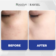 [Date 04/12/2026] Tinh chất Ampoule Cấp Ẩm và Làm Dịu Da RAVIEL Cica Panthenol 5% Calming 30ml - RV000003 - Rosslyn